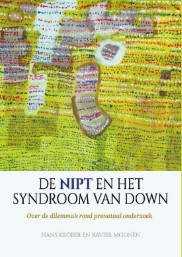 De NIPT en het syndroom van Down